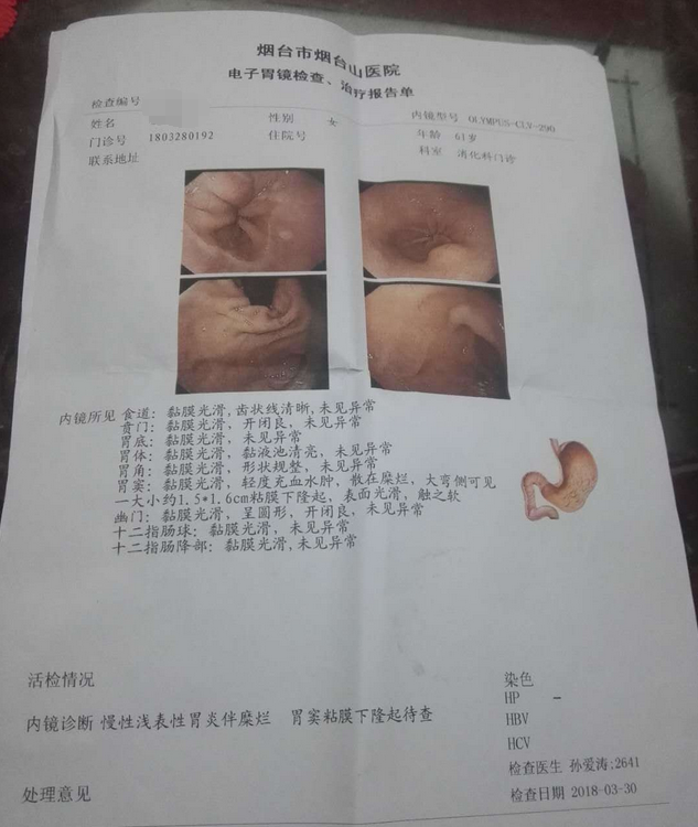 胃炎伴糜烂胃窦粘膜下隆起 需要立即手术吗?