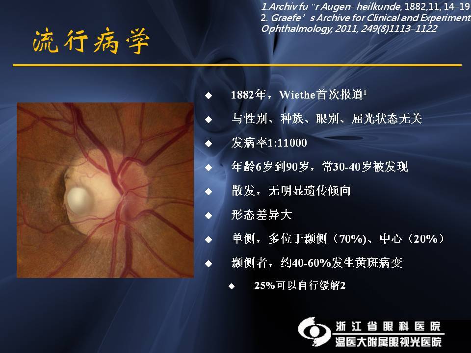 视盘小凹相关黄斑疾病