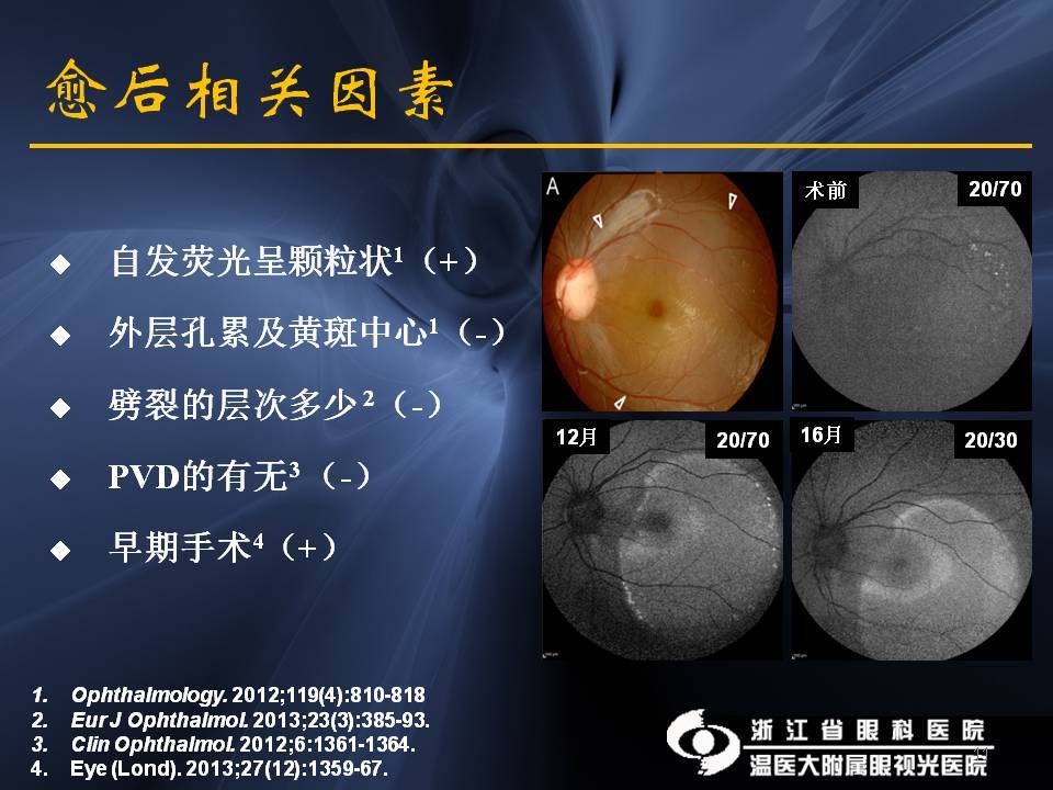 视盘小凹相关黄斑疾病