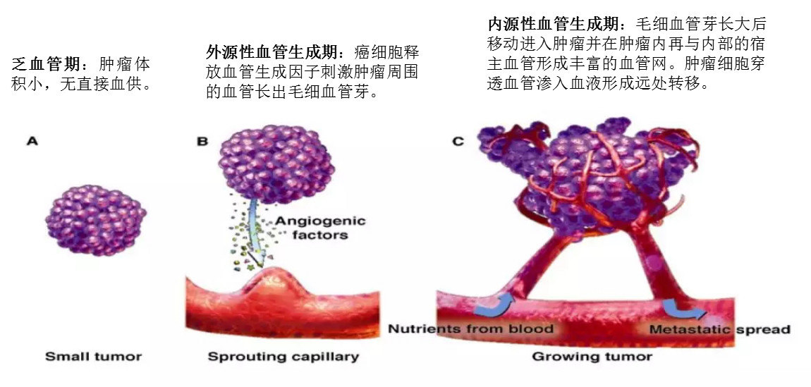 肿瘤微血管移动-联通征三阶段示意图