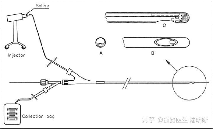 cragg brush导管等装置将血栓软化或粉碎 抽吸取栓:使用血栓抽吸导管