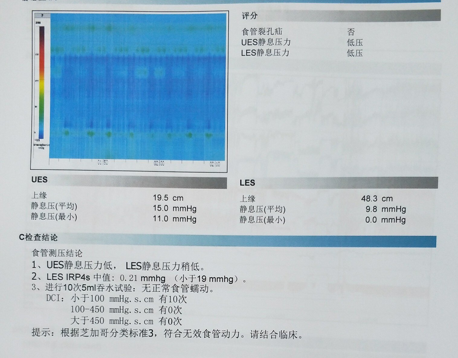 3,24小时ph监测和食道测压结果如果显示有严重的酸反流,可以考虑换用