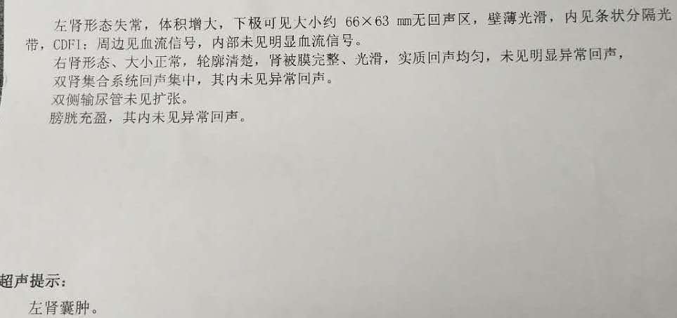 当地医院彩超显示左肾囊肿附相关图片