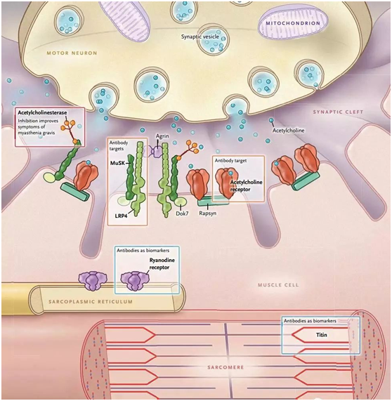 在一些人群中,血清achr-ab阴性mg中40～70%可检测到musk自身抗体,故