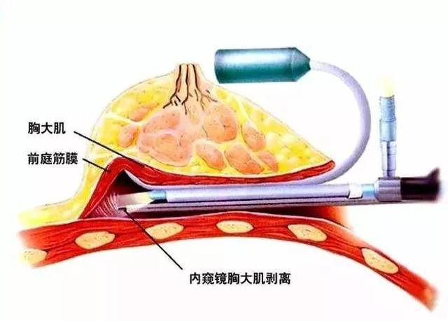 有哪些特点呢?