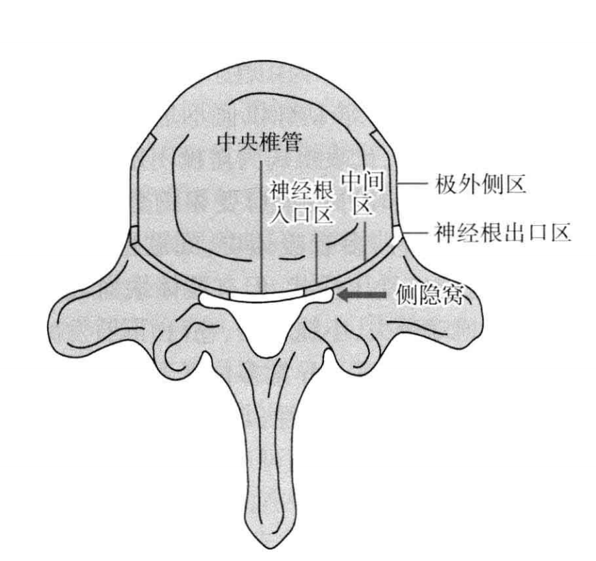 spinal stenosis,lss)是一种可导致脊柱椎管,椎间孔及侧隐窝解剖性