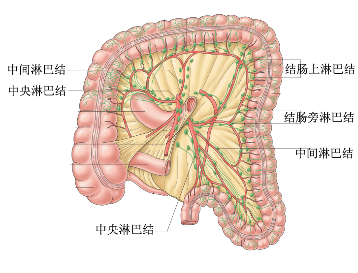 大肠癌的转移途径有哪些