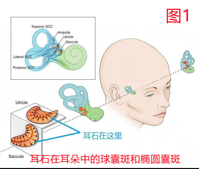 耳石是位于我们正常内耳前庭池中的椭圆囊斑和球囊斑上的位置感受器上