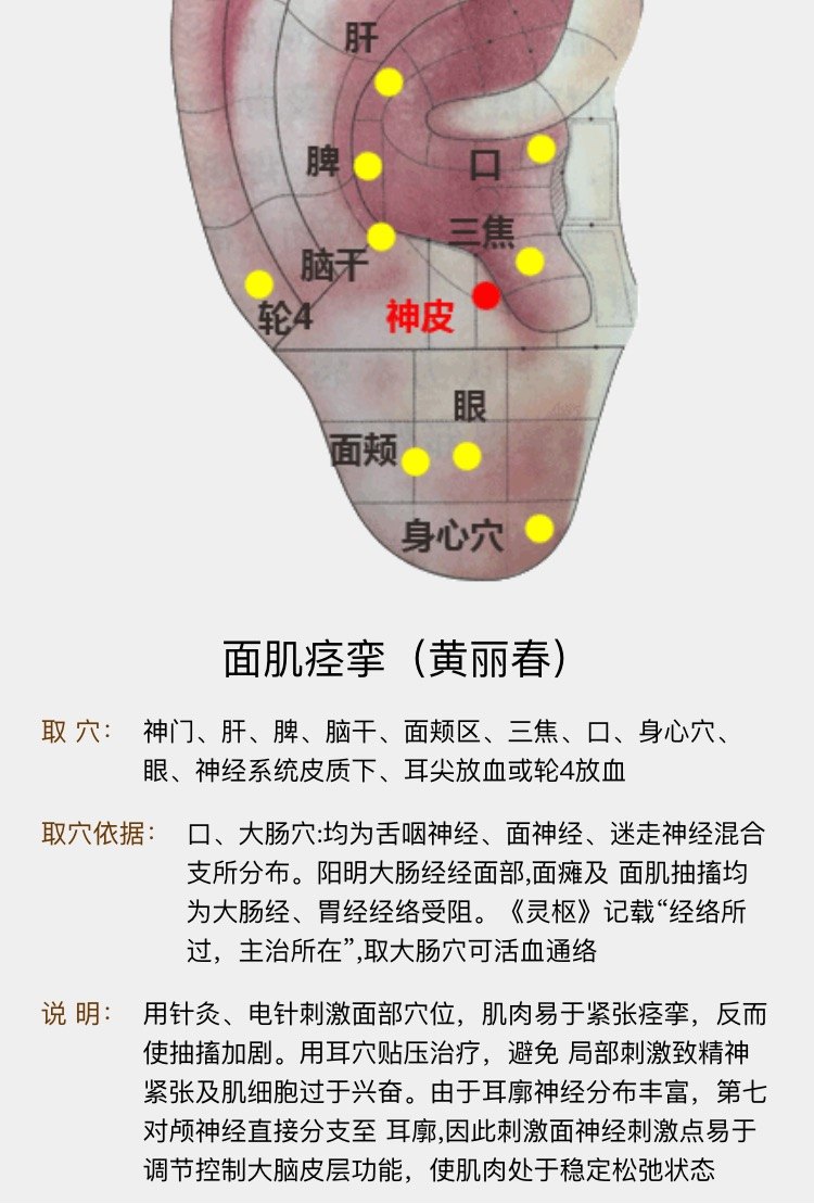 颅神经疾病中西医结合一体化治疗方案面肌痉挛面瘫连带运动三叉神经痛