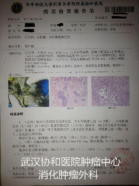 胃癌(腹膜后转移)患者病例