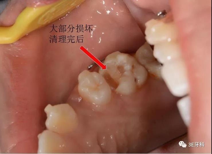 口腔中你看不见的