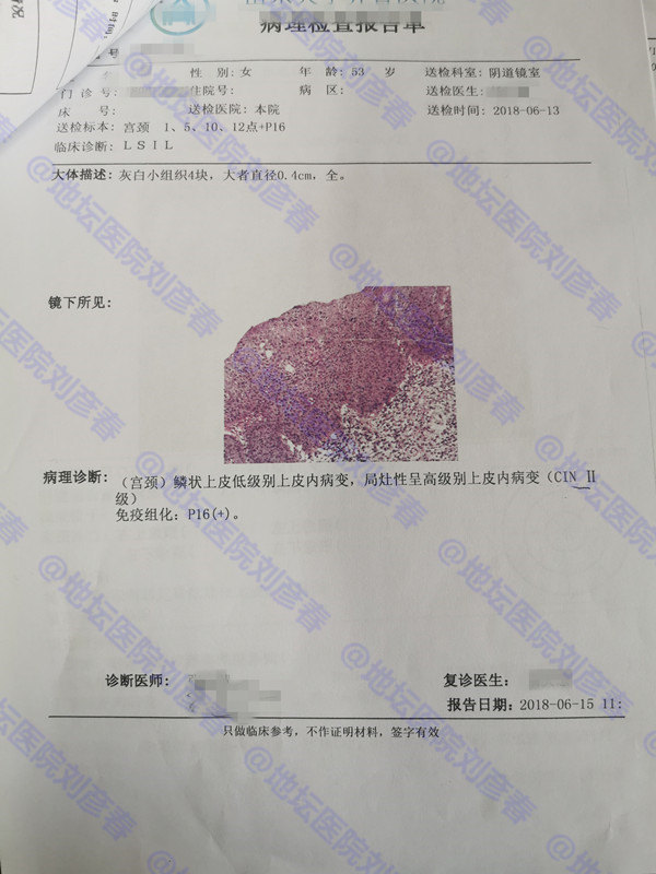 【病例分享】_宫颈癌前病变 好大夫在线