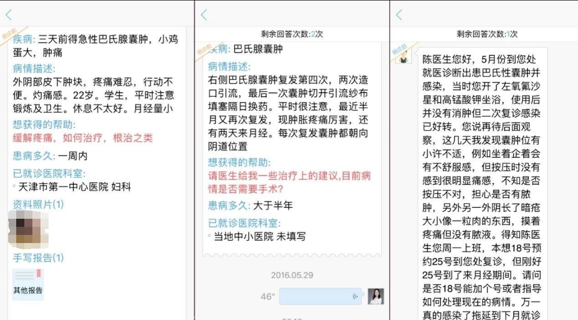 巴氏腺囊肿—每个女性都该了解的"良性疾病"_前庭大腺囊肿 好大夫