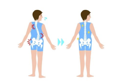 成人脊柱侧弯怎么治疗应该这样做