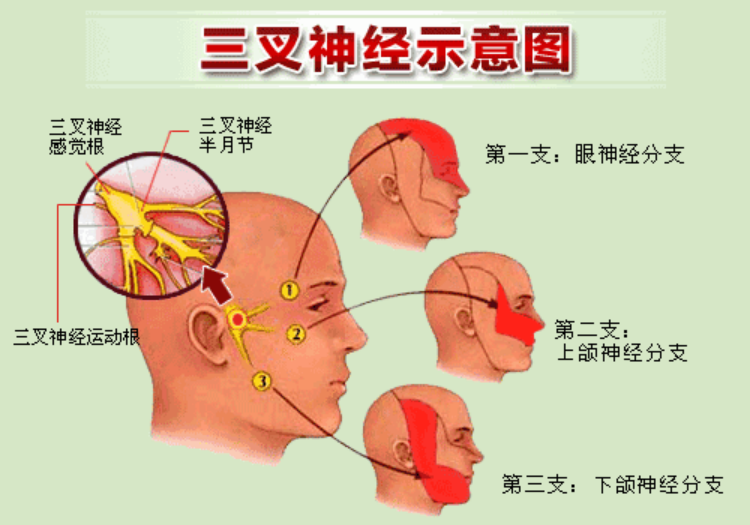 三叉神经面部感觉的分布范围下颌支(第三支v3)上颌支(第二支v2)三叉