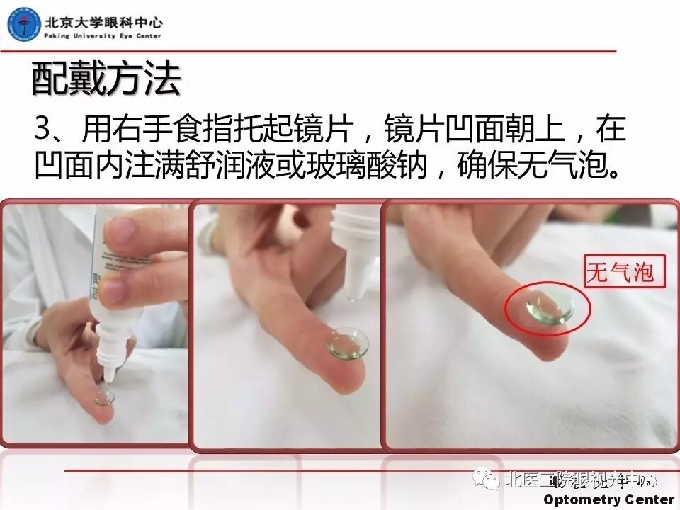硬性角膜接触镜摘戴方法(北京大学眼科中心)