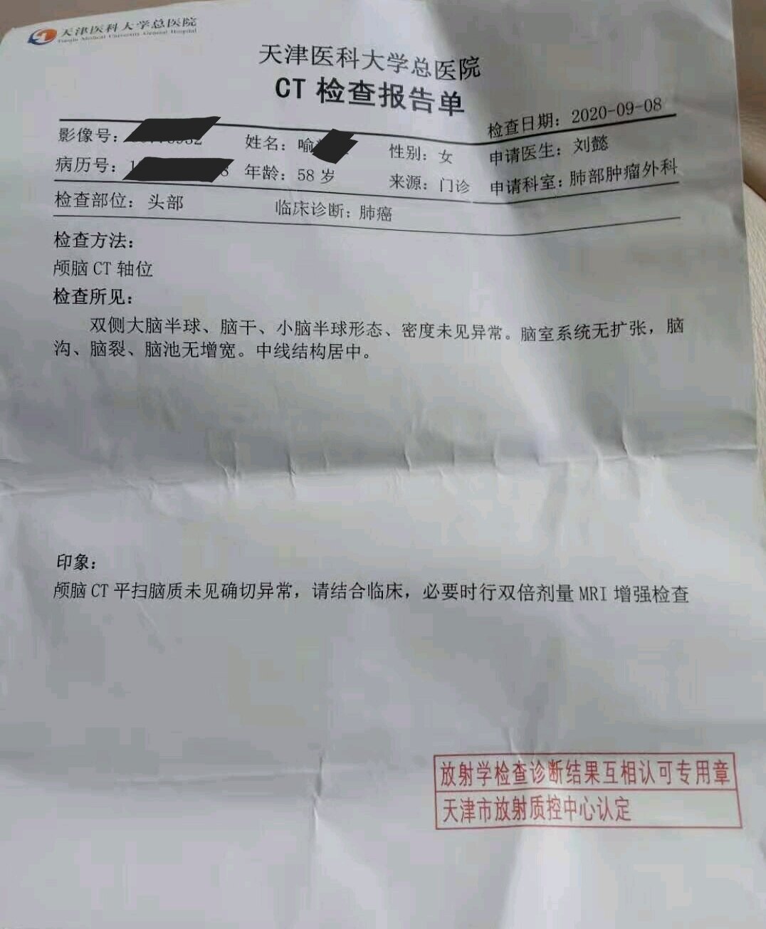 刘懿博士说肺癌一七七五肺癌术后颅脑ct发现问题担心转移怎么办