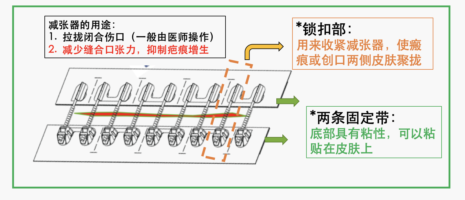 皮肤减张器的使用和疑问解答