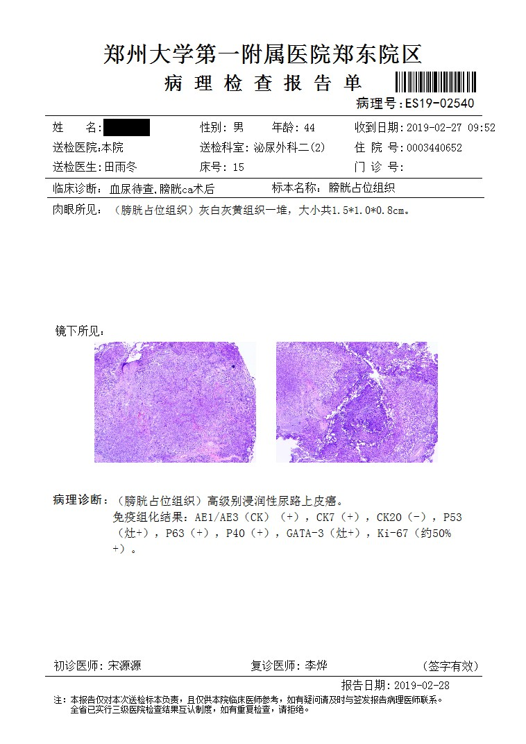 腹腔镜下膀胱根治性切除术 盆腔淋巴结清扫术 原位新膀胱术