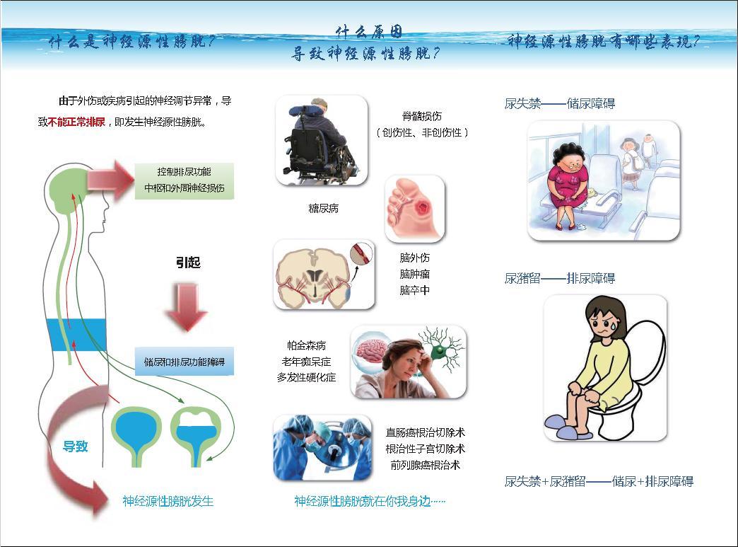 原创 认识神经源性膀胱