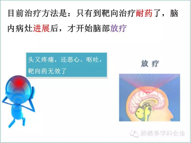 乳腺癌放疗后皮肤图片_放疗科医生收入(2)