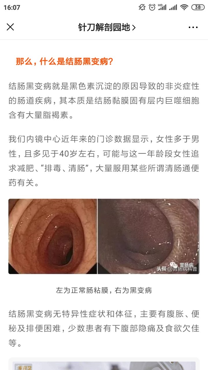 带您重新认识结肠黑变病(二)