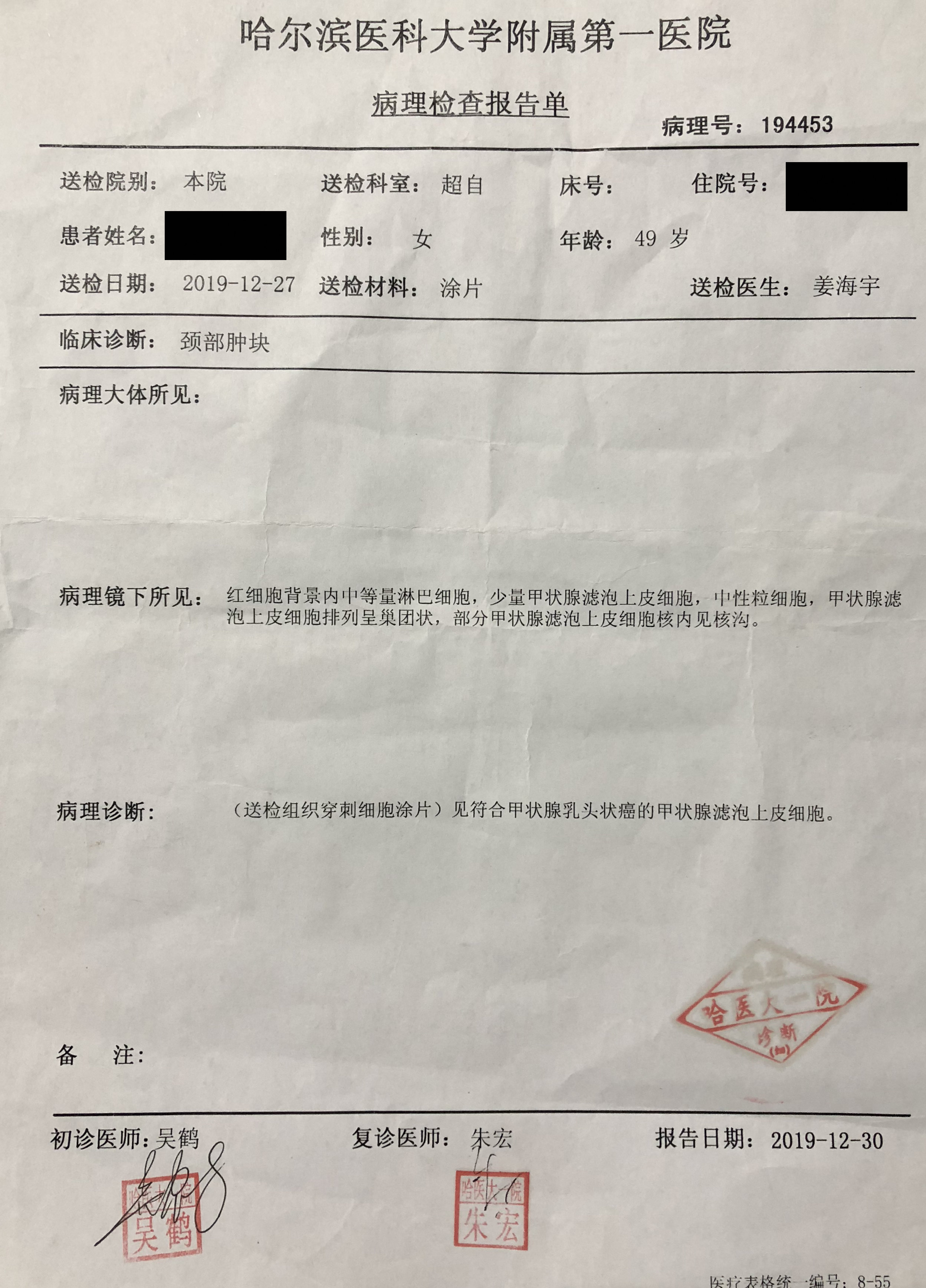 重视甲状腺癌的初始治疗—甲状腺癌病人三次手术有感