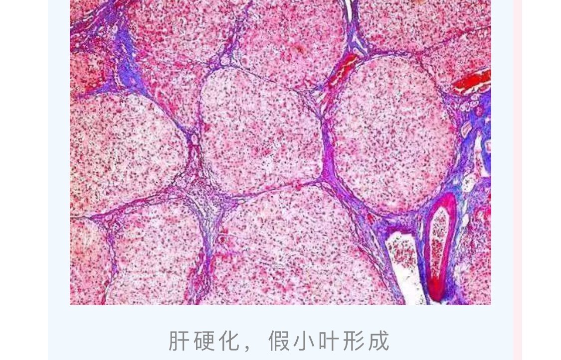 把正常肝脏切片通过he染色放在光学显微镜下,我们可以看到一个非常