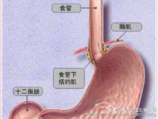 到底什么是胃食管反流?