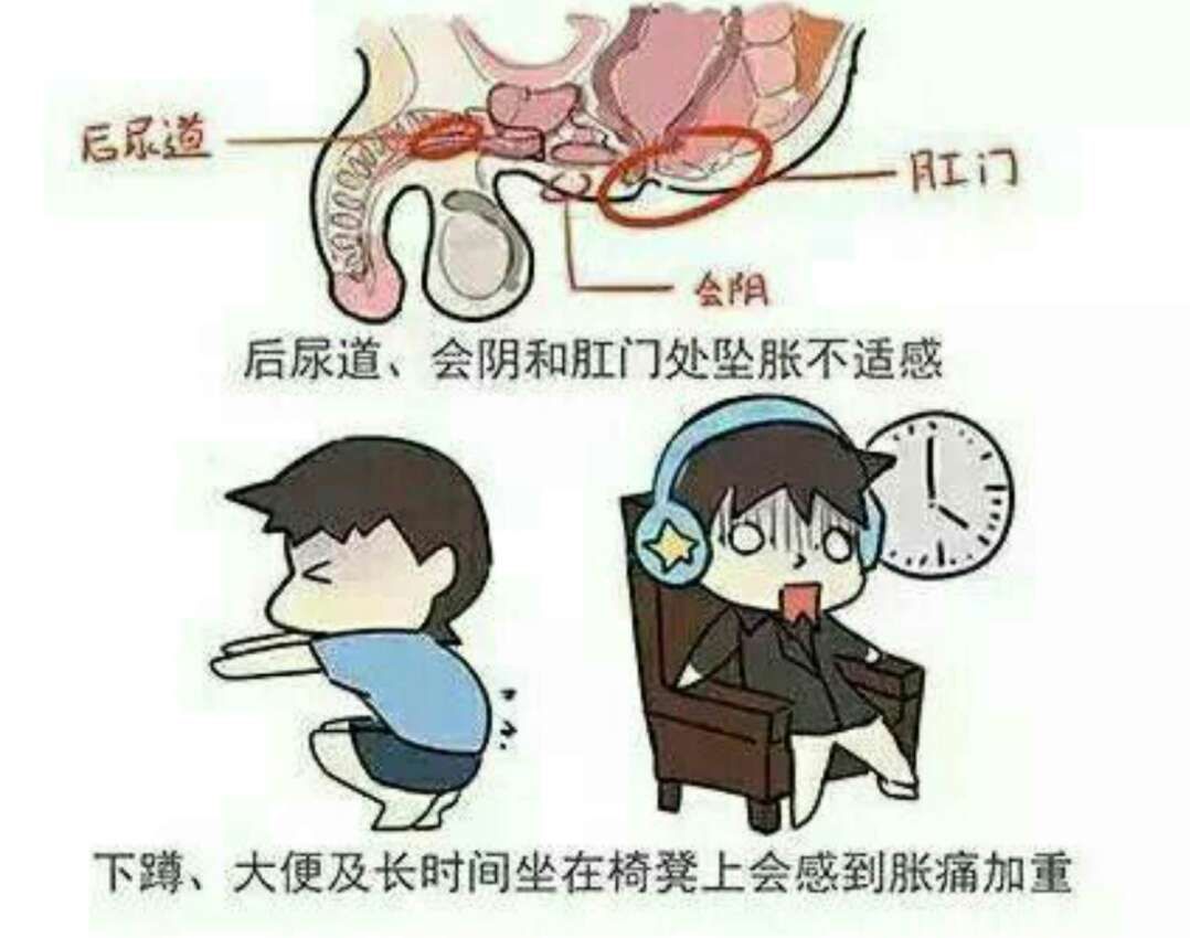 前列腺炎_症状_疾病介绍
