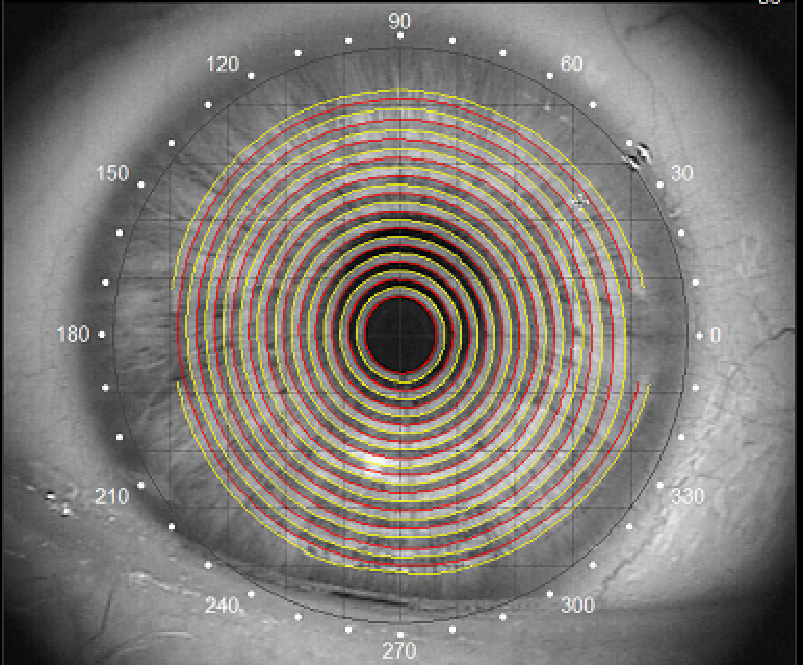 角膜地形图&像差原理解读(上)