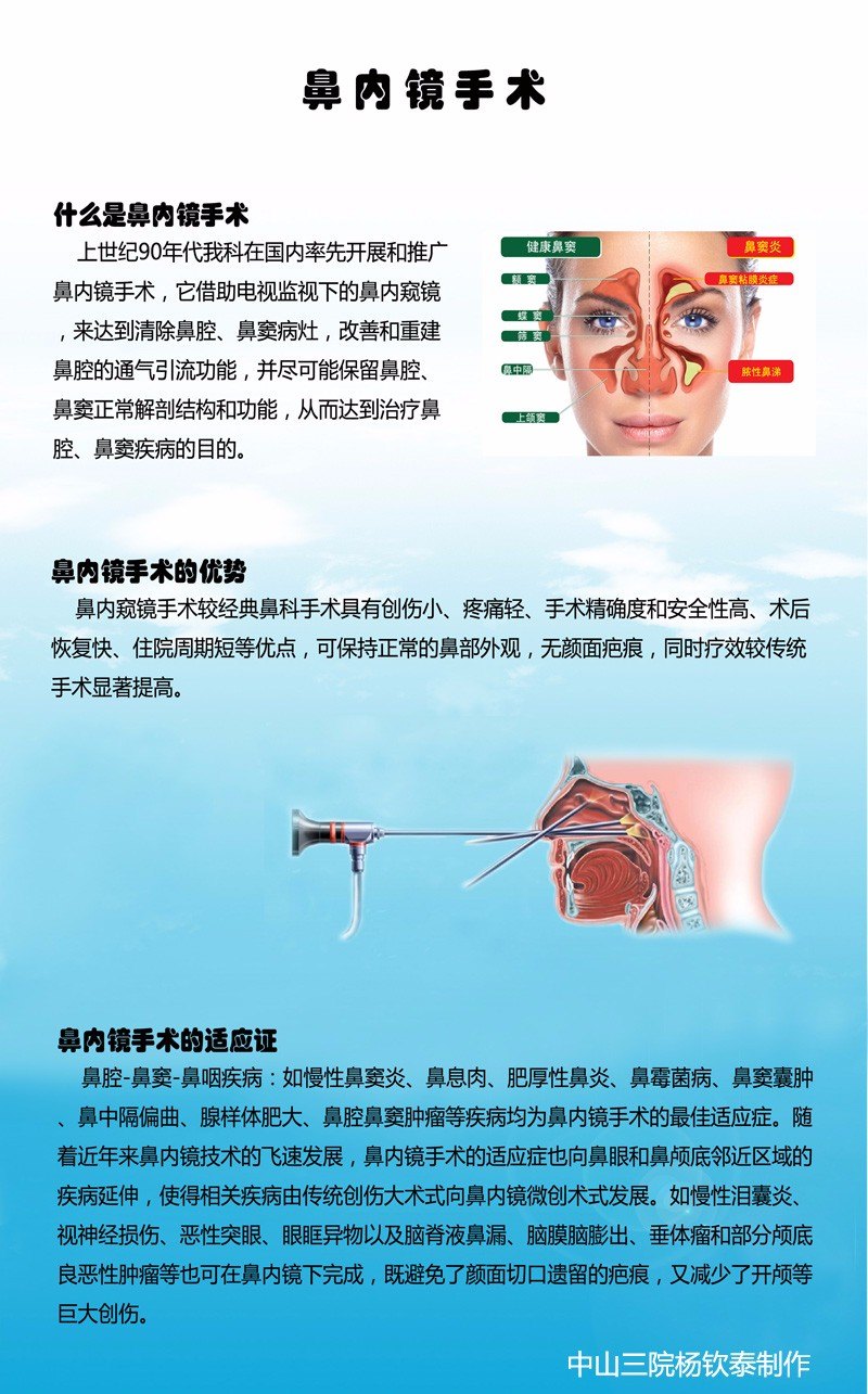 什么是鼻内镜微创手术