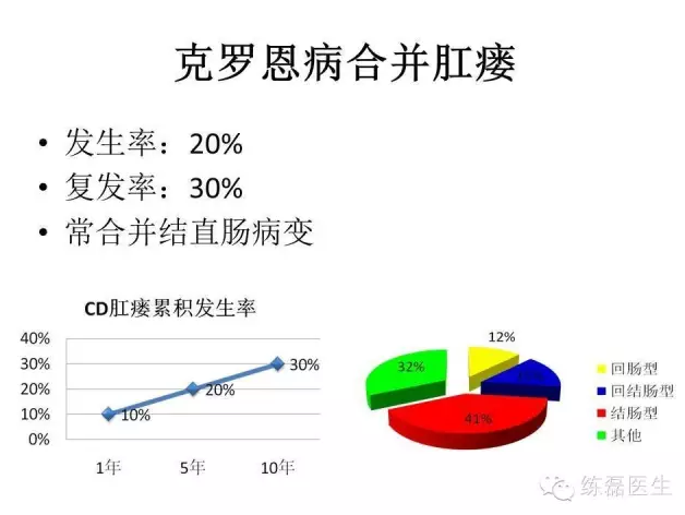 克罗恩病肛瘘诊治指南解读