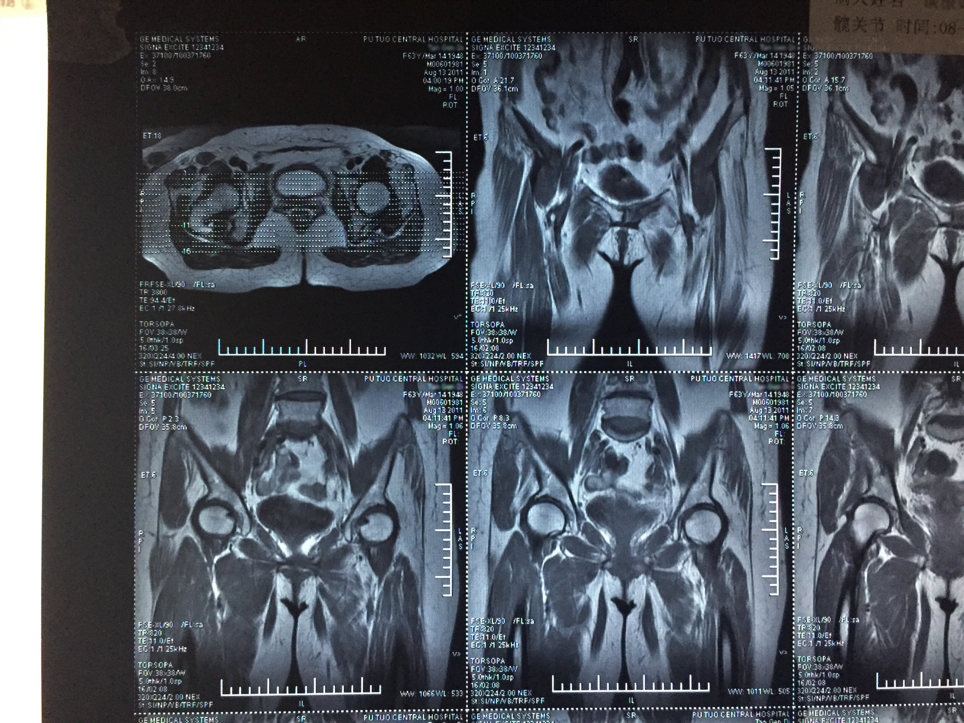 CT和MRI的区别你清楚多少，看完这篇文章就明白了_成像