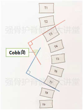 cobb角度数的测量存在3°5°