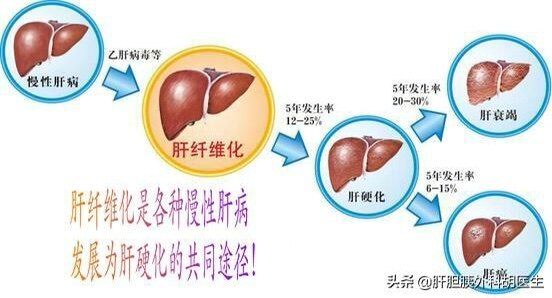 还有,对于有慢性肝病的患者,每半年一次的肝功能,甲胎蛋白和普通肝脏