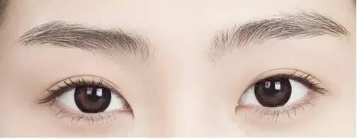 如何选择双眼皮手术?