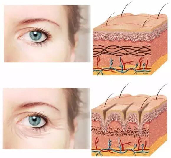 女性年轻肌肤组织与衰老肌肤组织对比(图片来源网络 请供参考)