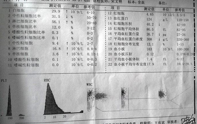 传染性单核细胞增多症4例体会