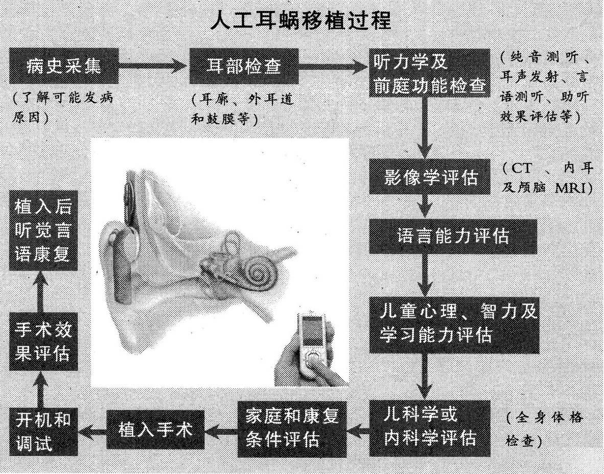 听说耳蜗的一般extructura 库存例证. 插画 包括有 感觉, 内在, 鼓膜, 运河, 听到, 肌肉 - 32128341