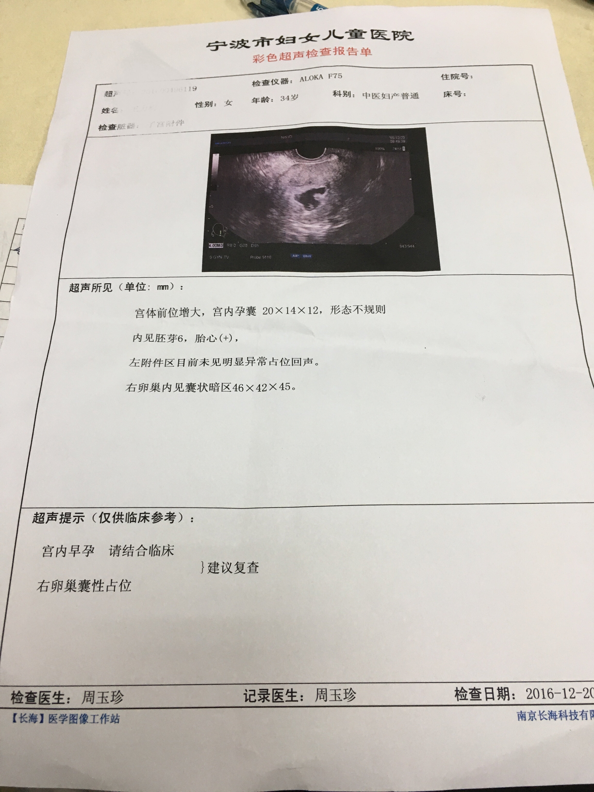 复发性流产,重度宫腔粘连 双侧输卵管不畅患者受孕一例