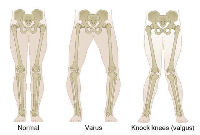 alignment-diagram-knee.jpg