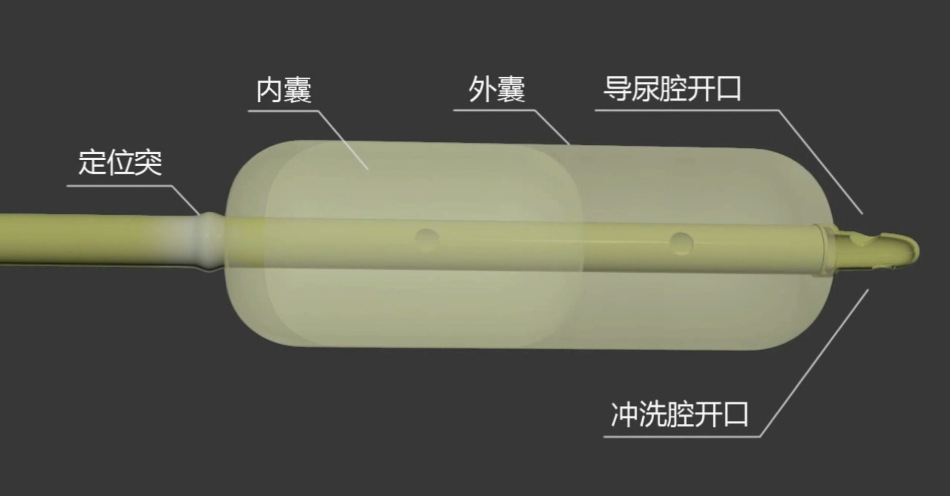 「前列腺增生」患者的福音:小小水囊显神威