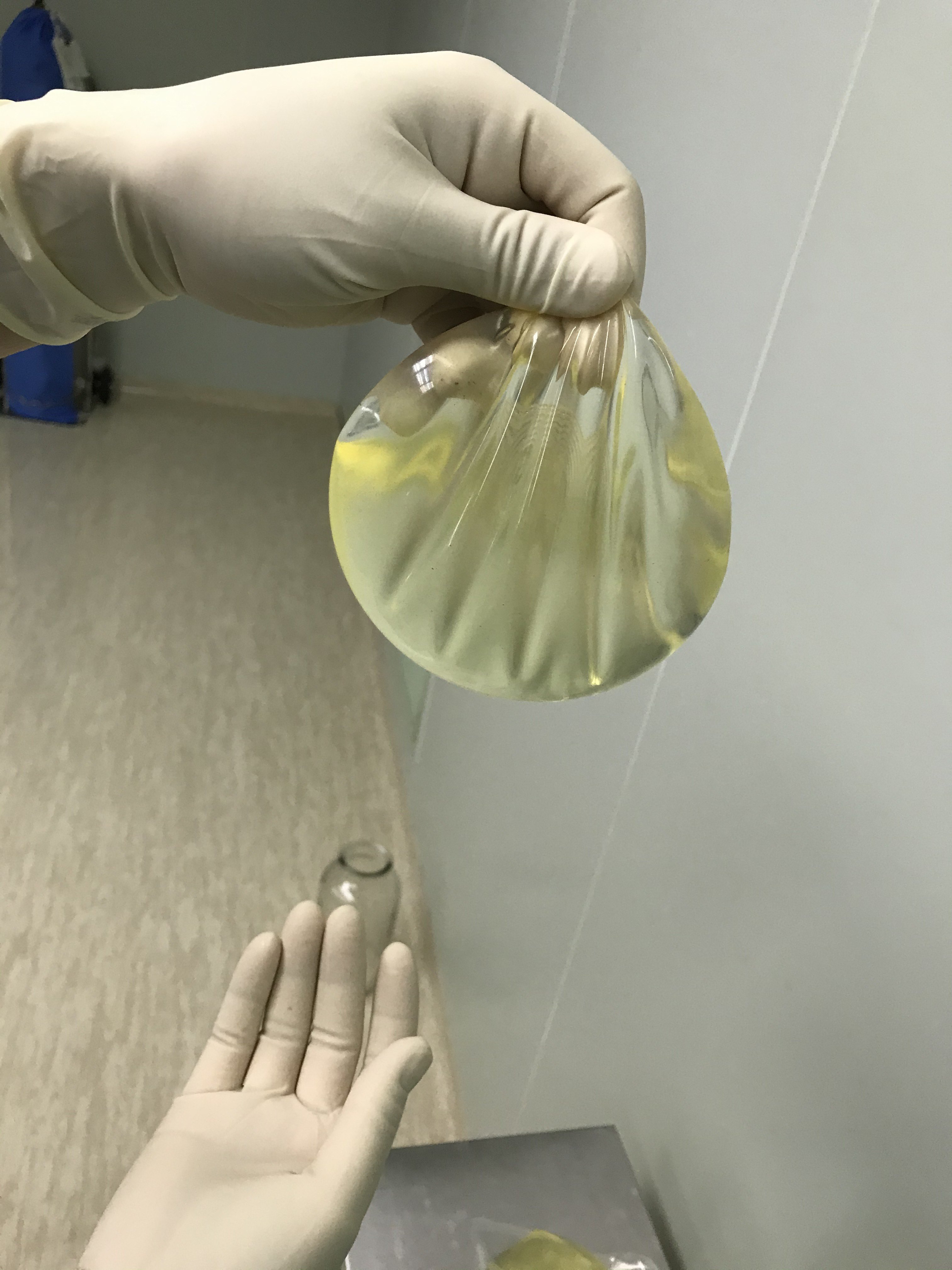 老一代的乳房隆胸假体要尽早更换或取出!