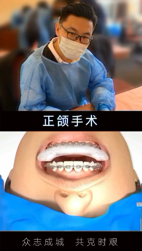 口腔科普:正颌手术_牙颌畸形_牙颌畸形