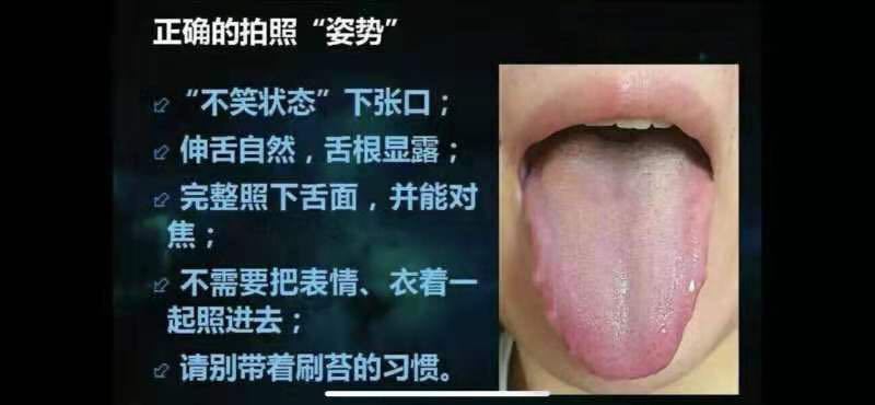 正确的舌象拍照姿势