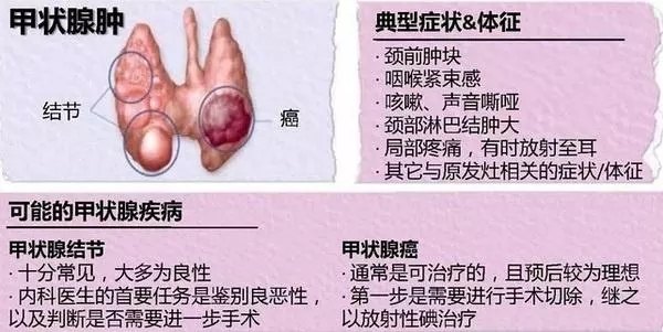 碘難治性甲狀腺癌治療的曙光—分子靶向治療