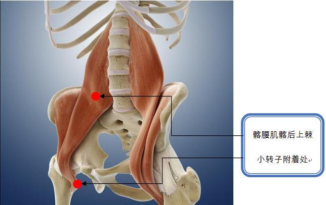 髂腰肌髂后上棘附着处痛点.jpg