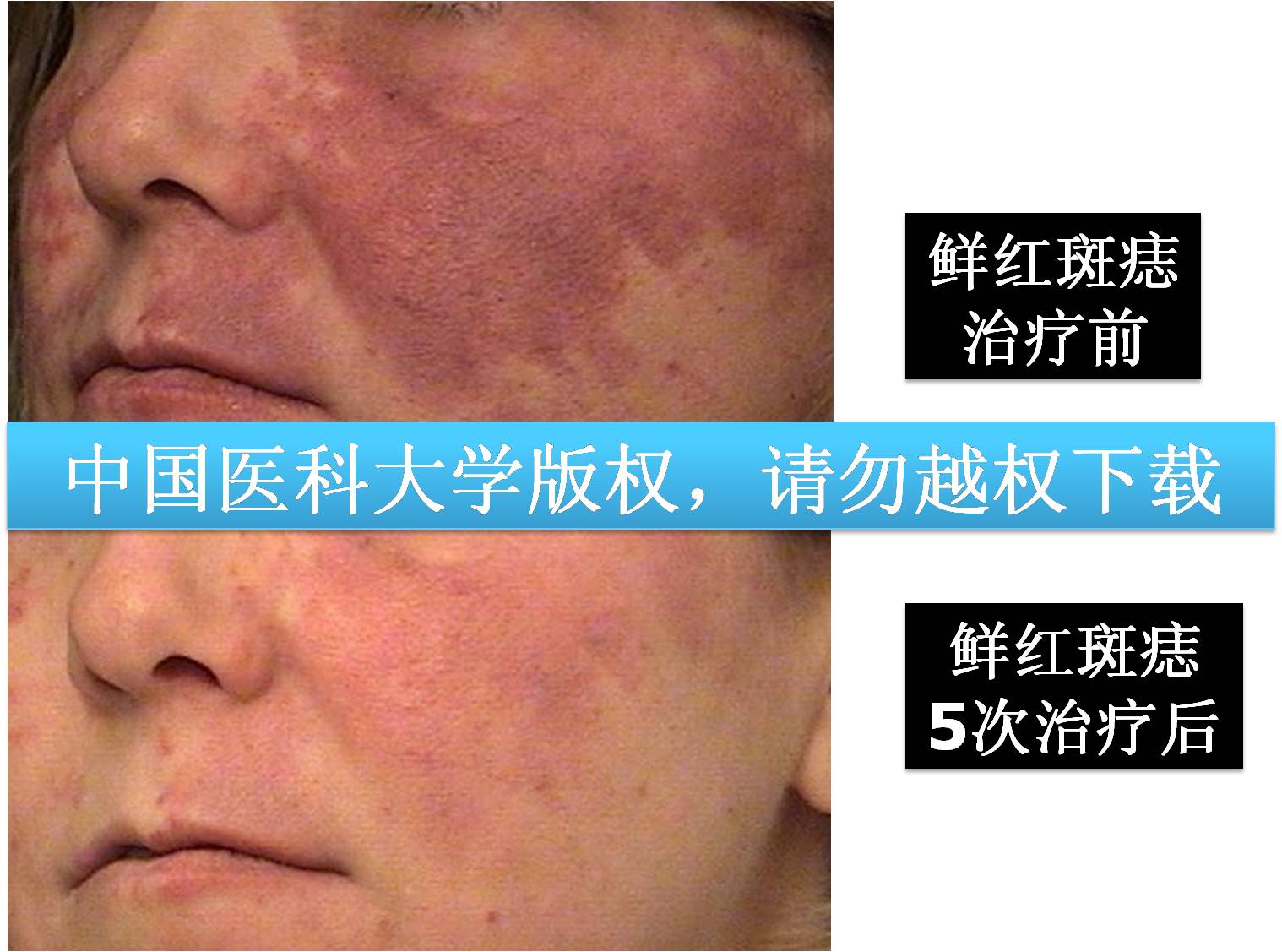 双波长激光cynergy工作站