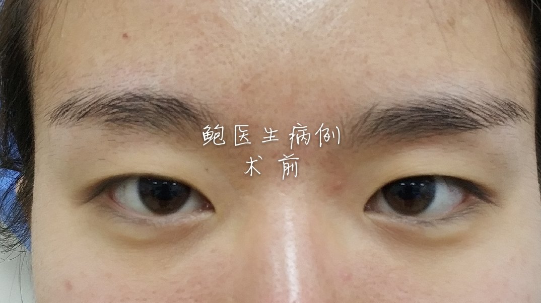 暂无